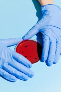 Bacterial growth in culture dish and rational use of antibiotics