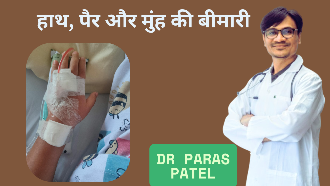 hand foot mouth disease in children in hindi by dr paras patel