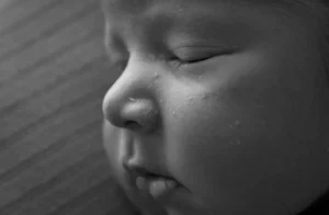 milia on a face of newborn