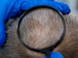 Seborrheic dermatitis in newborn