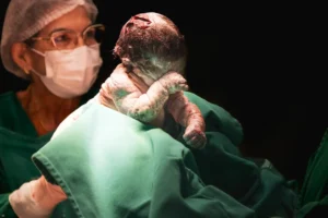 Newborn Baby Held by a doctor with vernix caseosa in a operation thearter