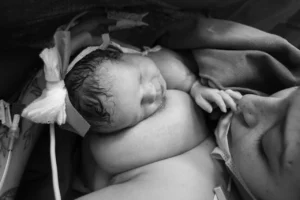Kangaroo Mother Care BY DOCTORS