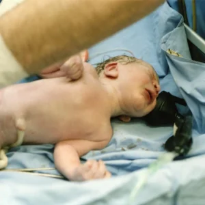 a newborn with umbilical cord in a delivery room