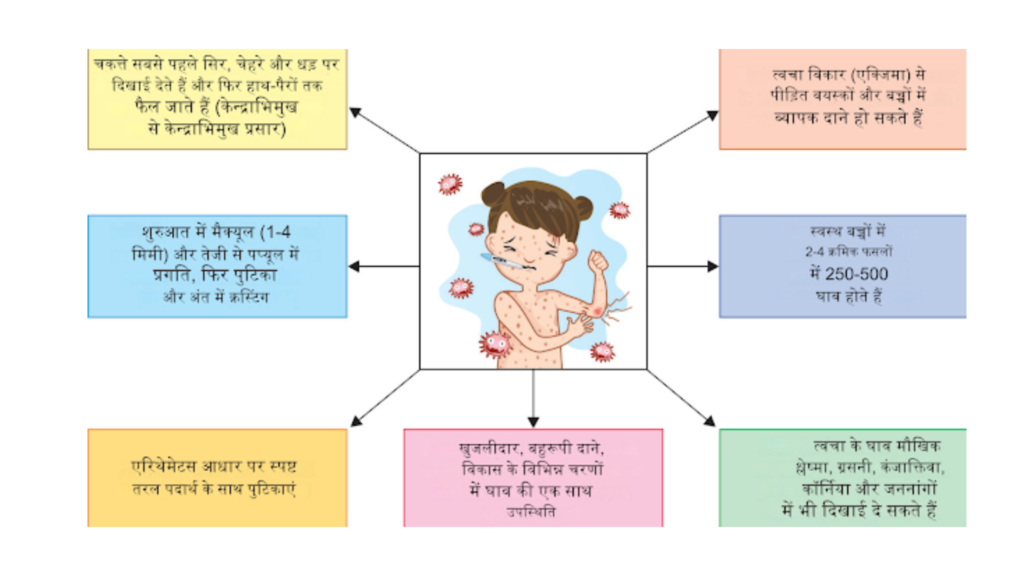 pathogenesis of vericella -1